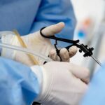 Удаление желчного пузыря лапароскопическим методом: особенности